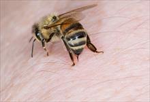 Cách sơ cứu khi bị ong chích